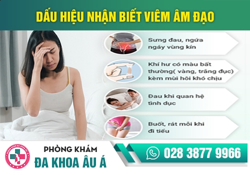 Sưng vùng kín ở nữ giới là dấu hiệu của bệnh viêm âm đạo